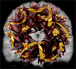 Brain Wreath