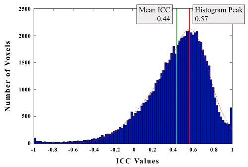 histogram skewed to left. Histogram showing the